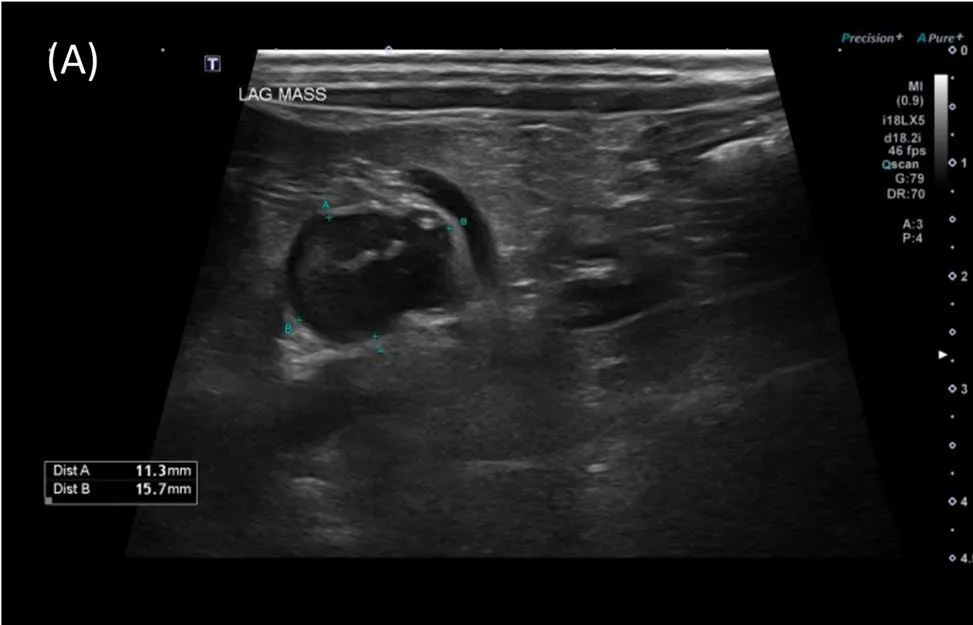 Adrenal mass, ultrasound, dog