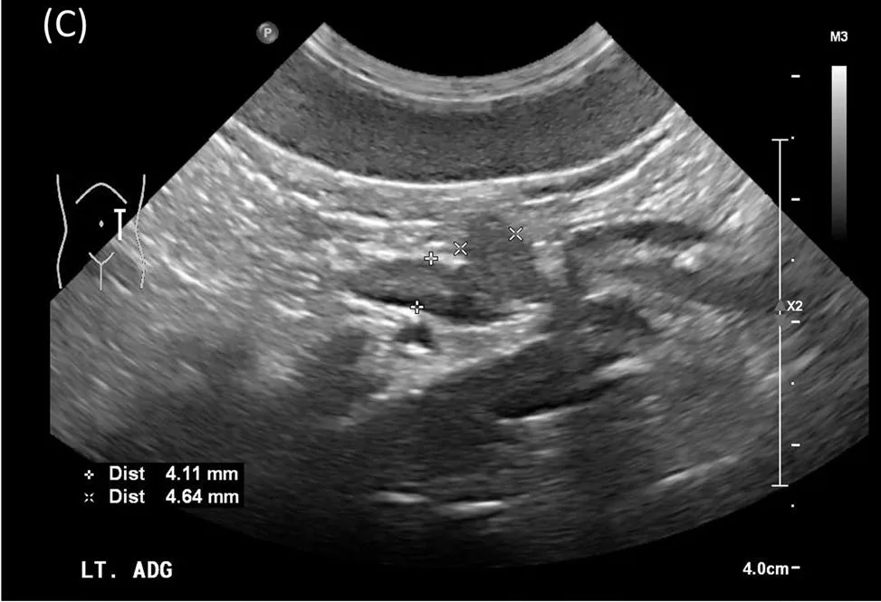 Normal left adrenal, ultrasound, dog