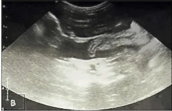 Free abdominal fluid, ultrasound, dog