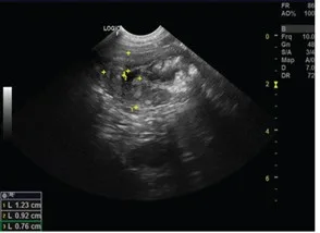 Cystitis: thickened wall, ultrasound, dog