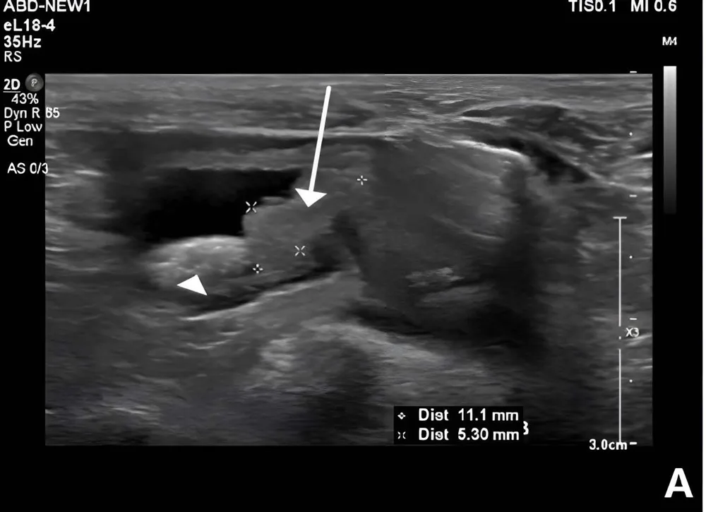 Mass at the trigone, ultrasound, dog