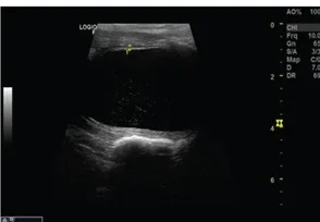 Thin, even wall, ultrasound, dog