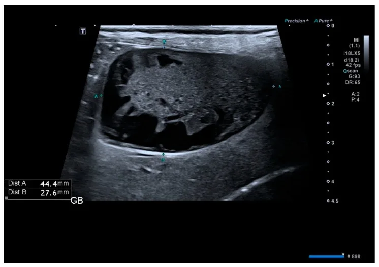 Gallbladder mucocele, ultrasound, dog