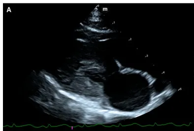 Hypertrophic cardiomyopathy, ultrasound, cat