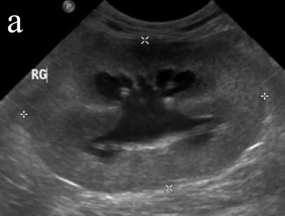 Hydronephrosis, ultrasound, cat