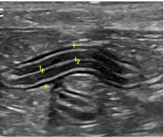 Normal jejunum, ultrasound, cat