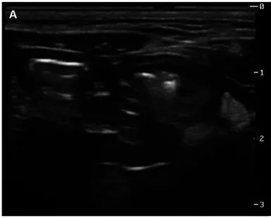 Obstruction, ultrasound, cat