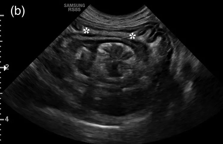 Intussusception, ultrasound, dog
