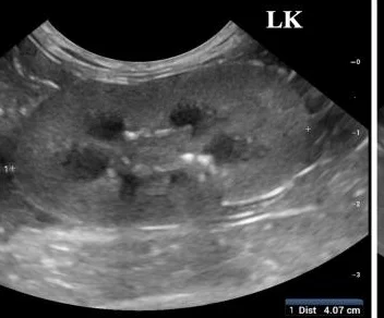 Normal kidney, ultrasound, cat