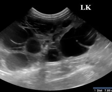 Polycystic kidney disease, ultrasound, cat