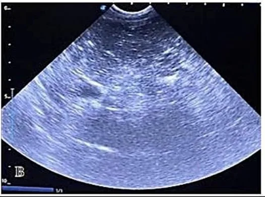 Diffusely bright liver, ultrasound, dog