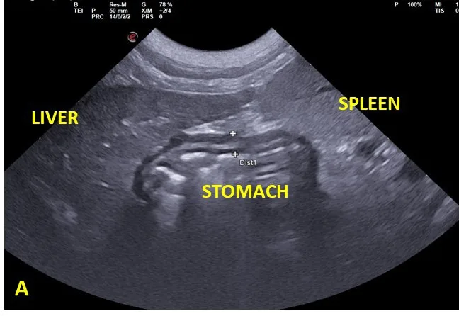 Normal liver, ultrasound, dog