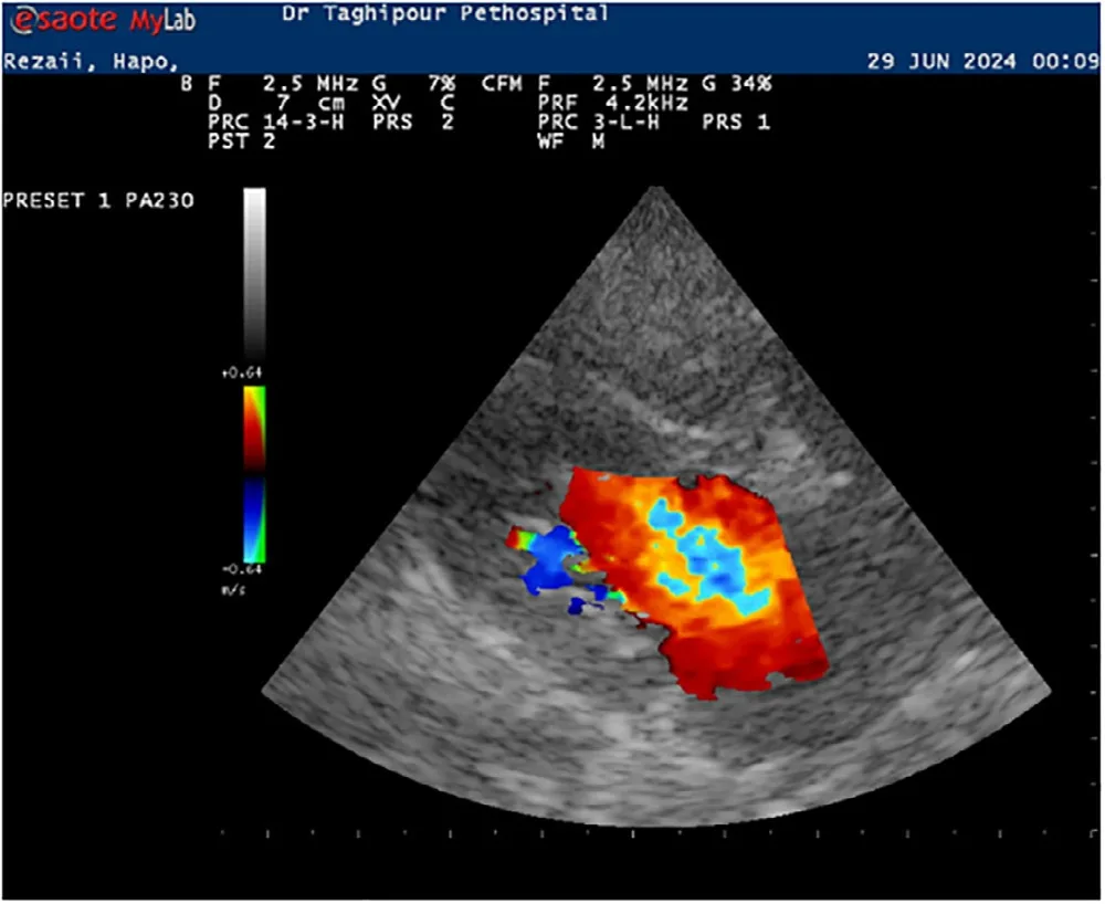 Mitral regurgitation, ultrasound, dog