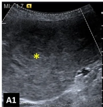 Haematoma, ultrasound, dog