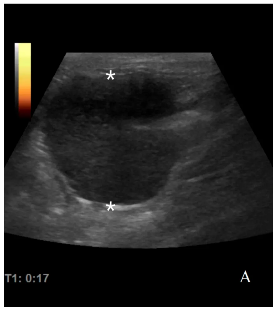 Gastric lymphoma, ultrasound, dog