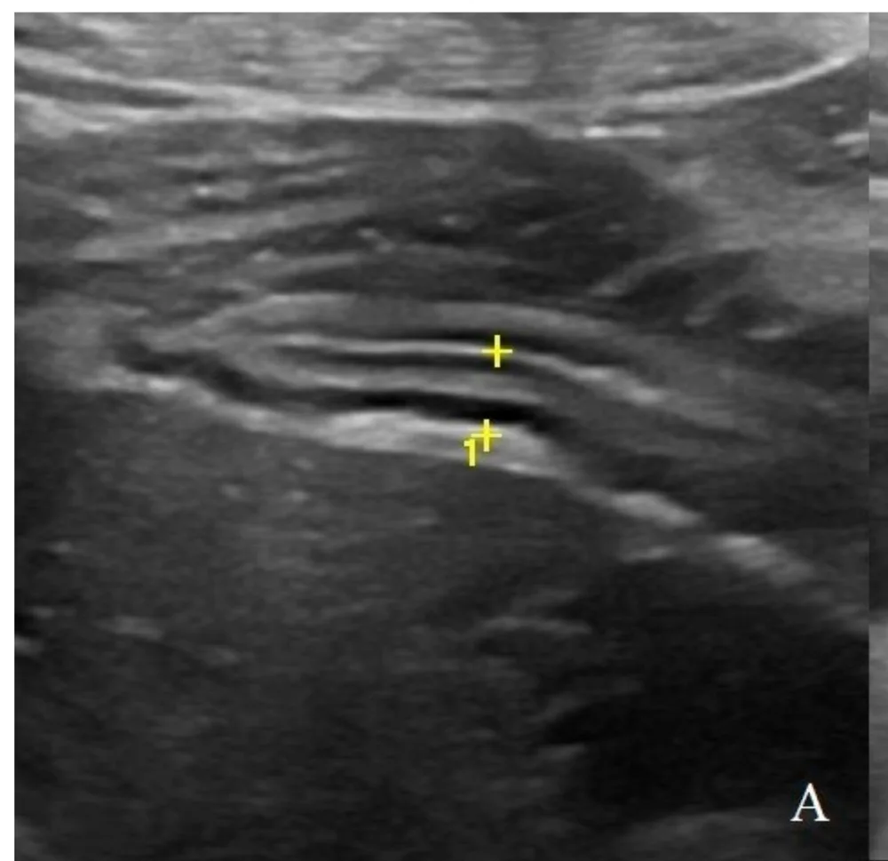 Normal stomach wall, ultrasound, dog