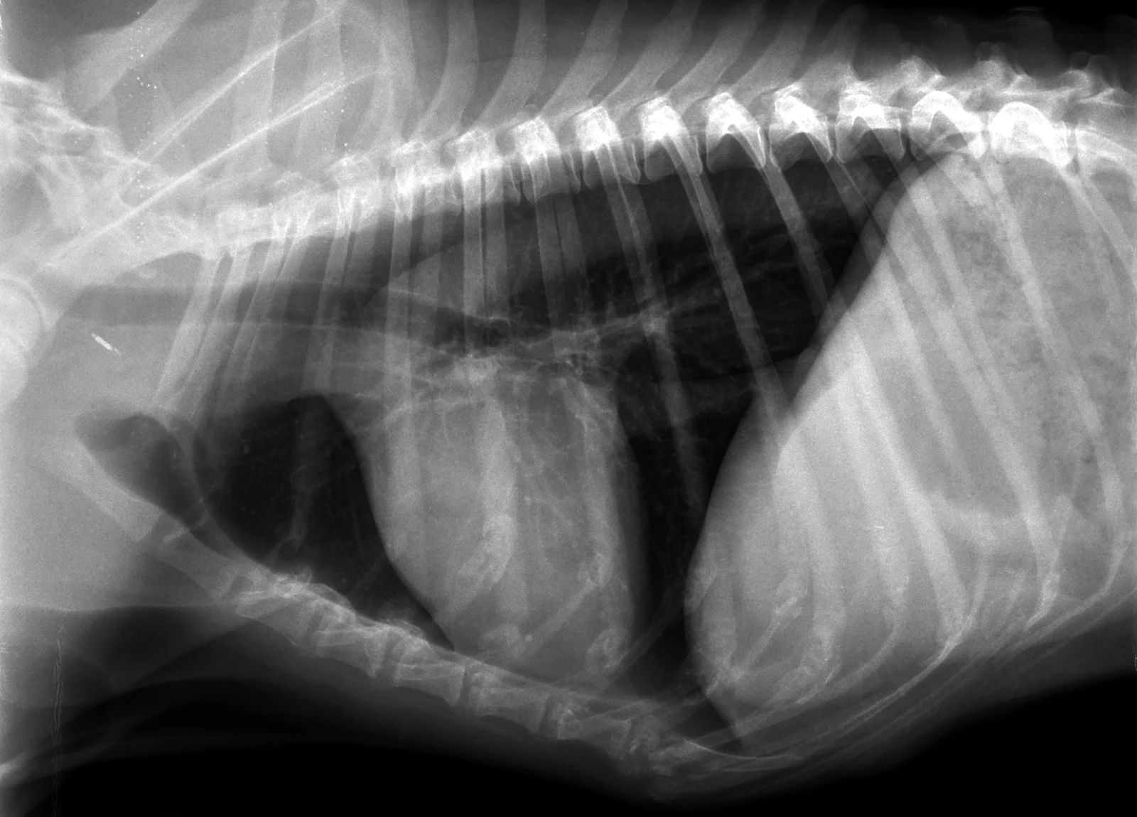 Normal thorax, lateral, X-ray