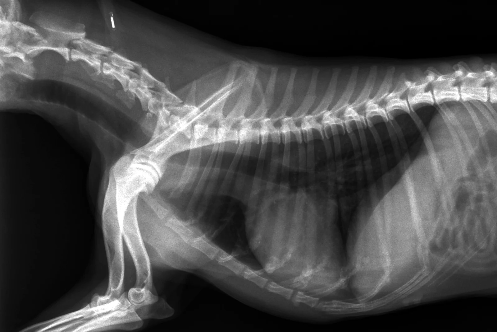 Normal lateral thorax