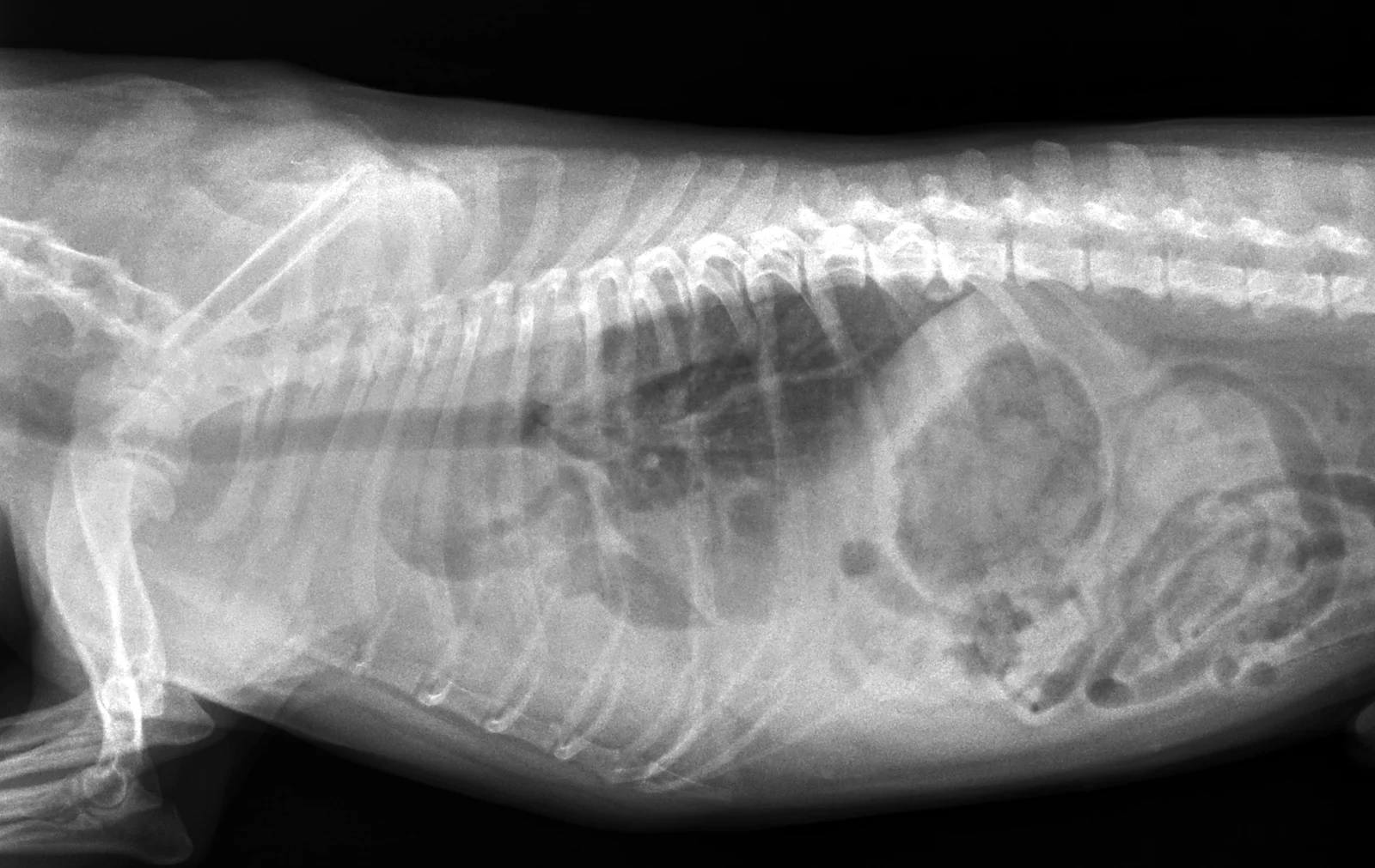Pleural effusion on a lateral thorax