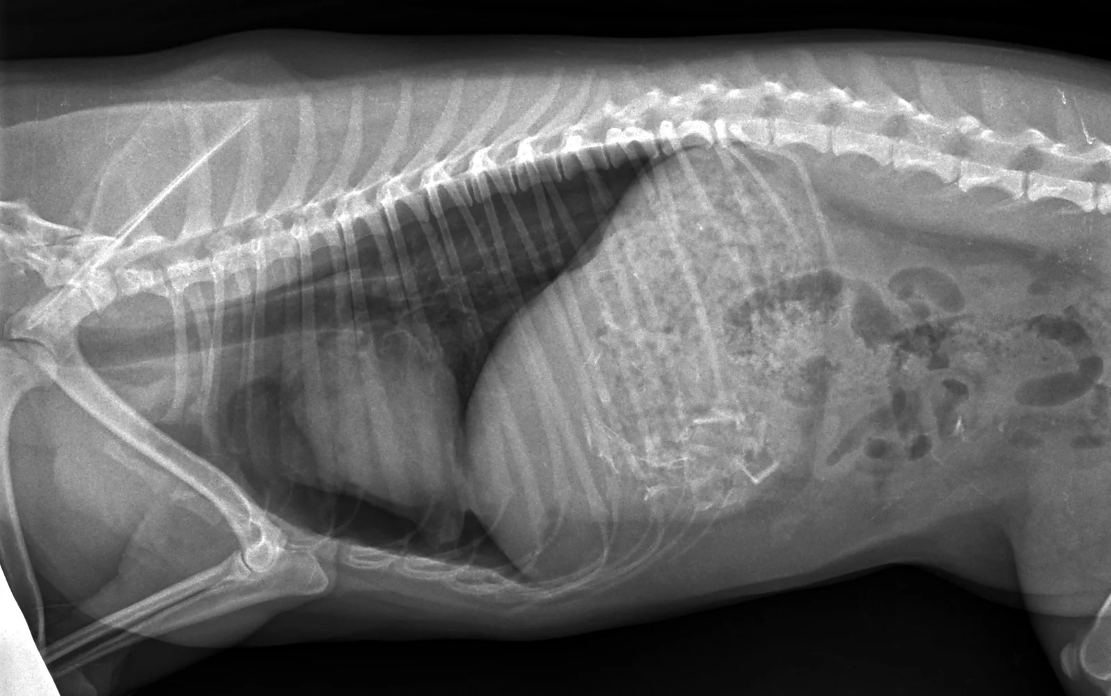 Pneumothorax on a lateral thorax