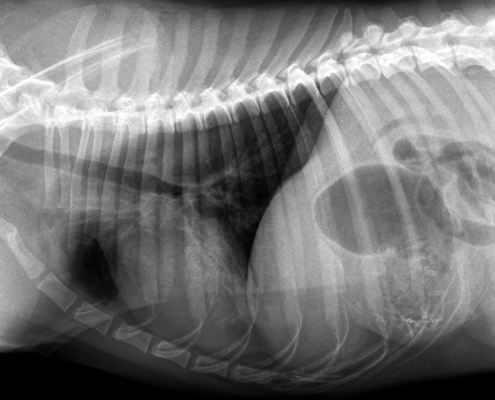 Alveolar pattern on a lateral thorax