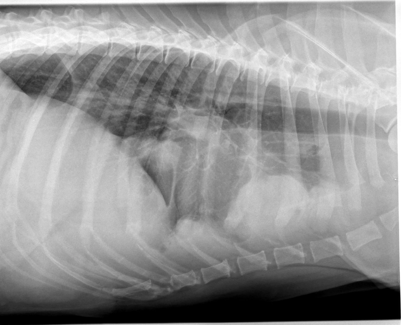 Thoracic mass on a lateral thorax