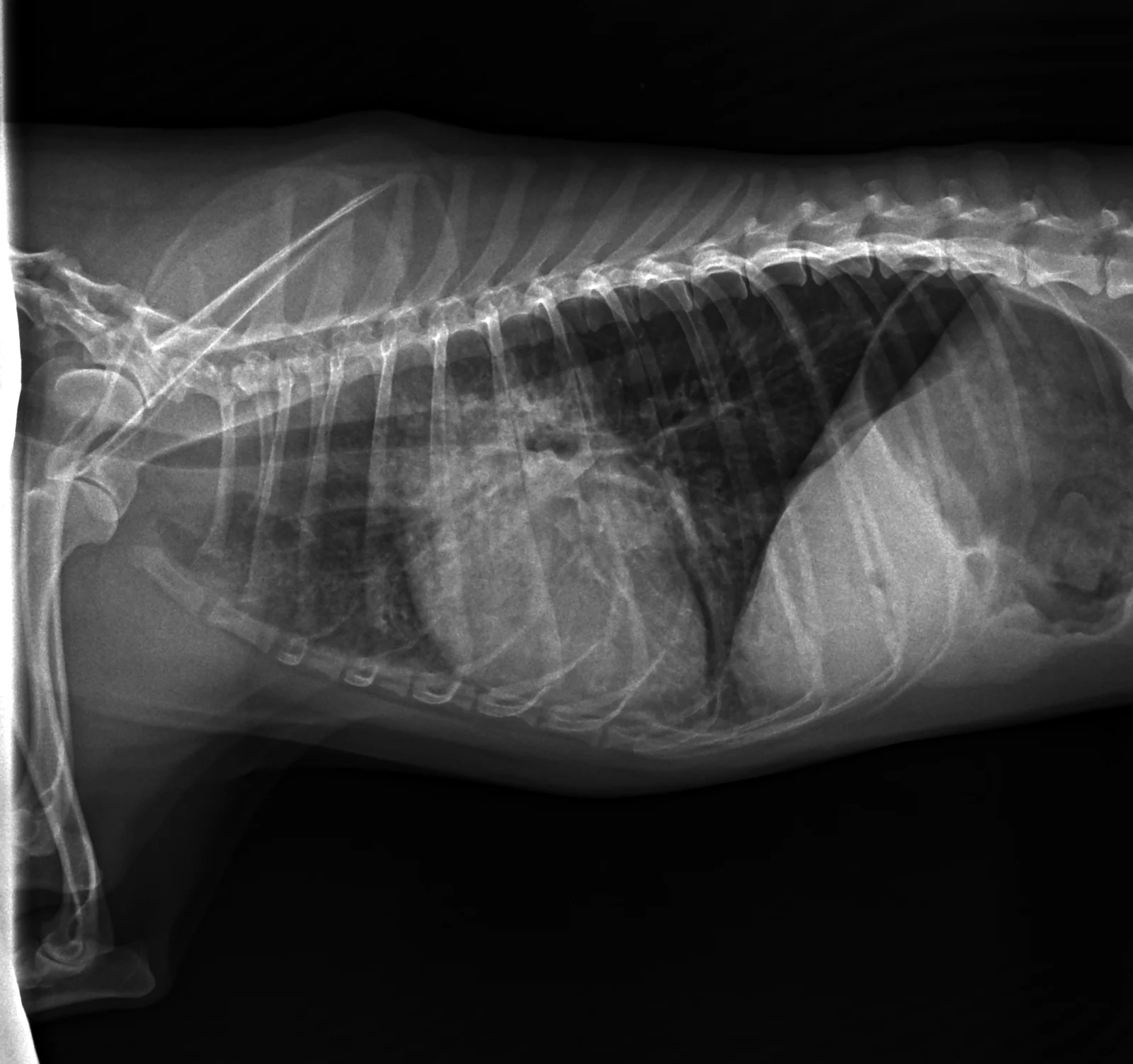 Bronchial pattern on a lateral thorax
