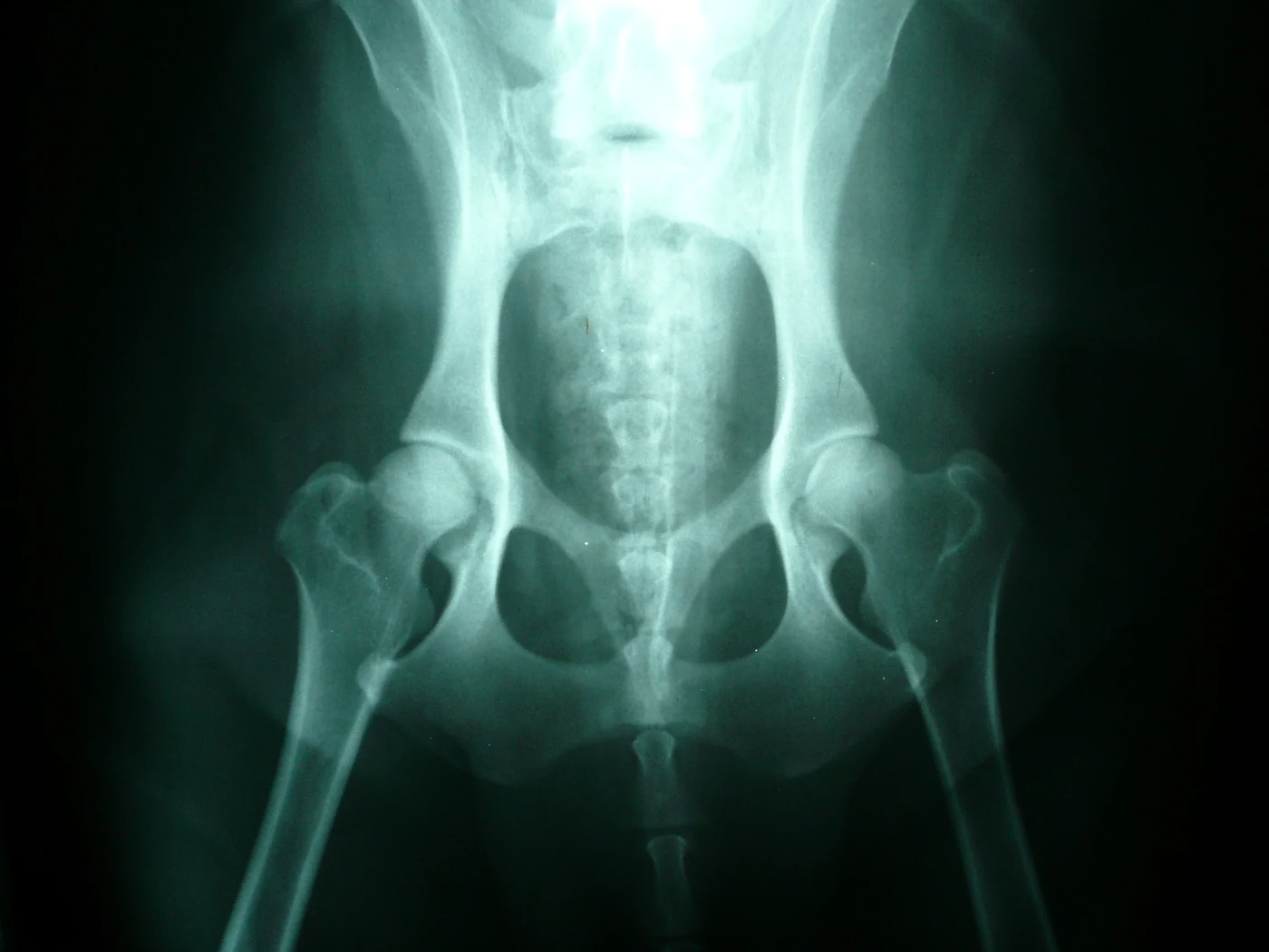 Normal hips, X-ray, dog