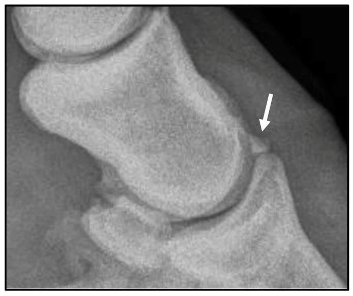 Extensor process fragment, X-ray, horse