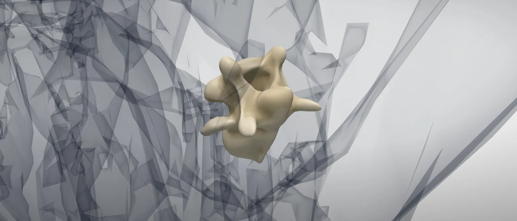 Cervical vertebra 7 (Vertebra cervicalis VII) of the horse: a three-quarter view of the bone.