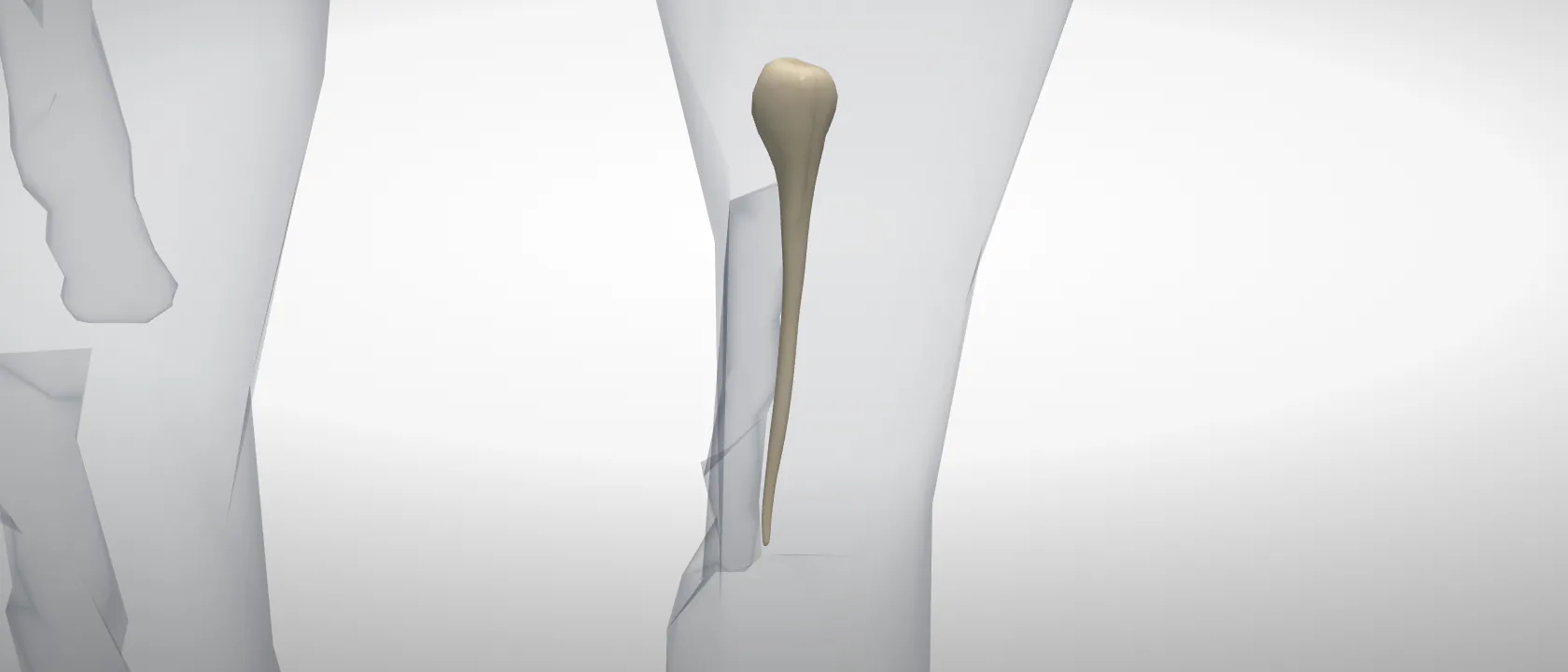 Os metacarpale II of the horse, left side: a three-quarter view of the bone.
