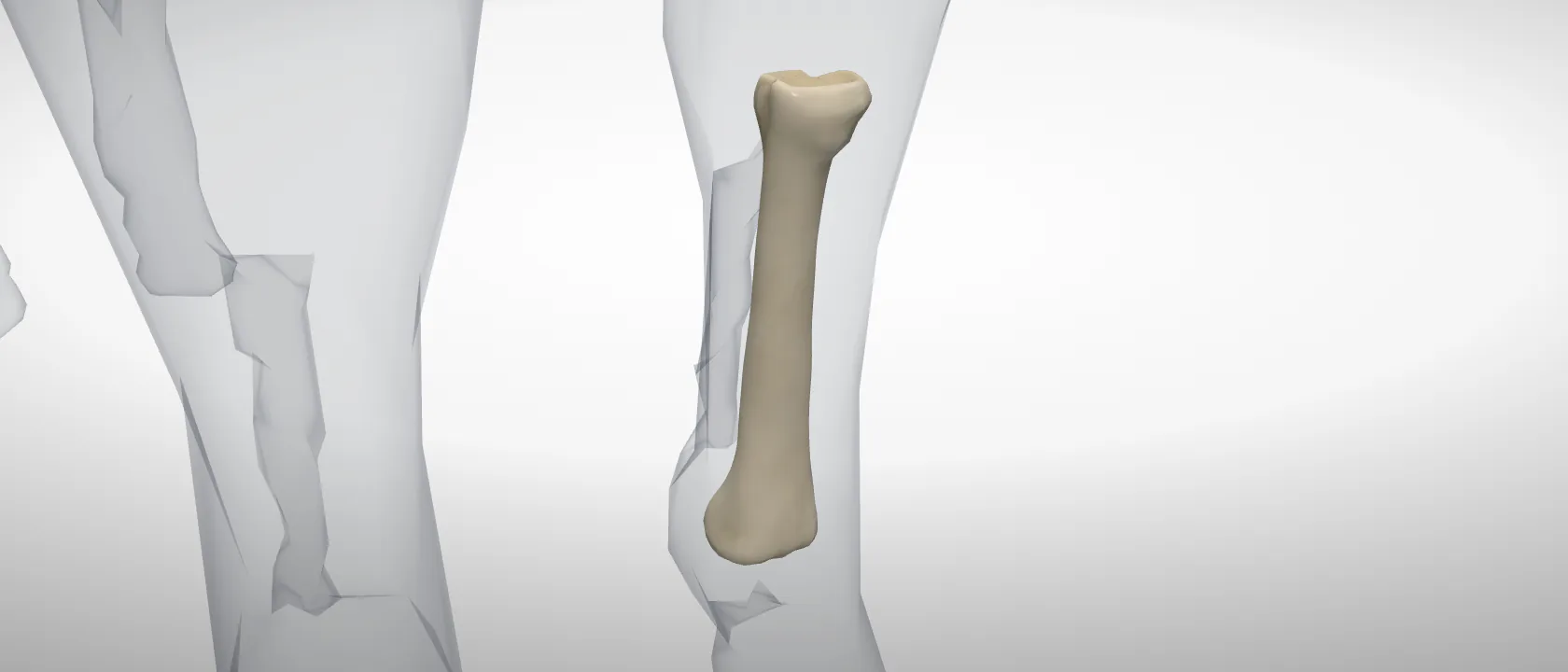 Third metacarpal (cannon) (Os metacarpale III) of the horse, left side: a three-quarter view of the bone.