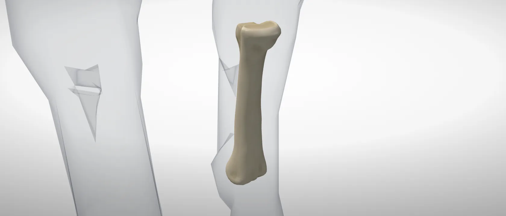 Third metatarsal (cannon) (Os metatarsale III) of the horse, left side: a three-quarter view of the bone.