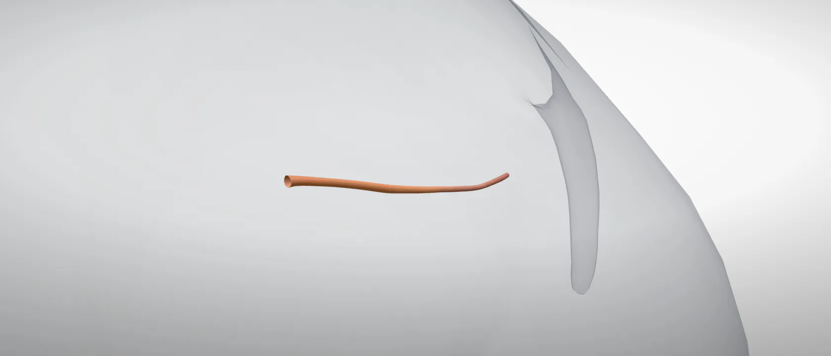 Female urethra (Urethra feminina) of the pig: a three-quarter view of the urinary.